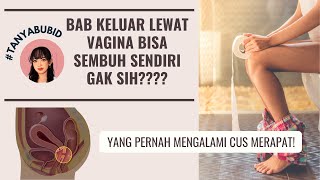 BAHAYA BAB KELUAR LEWAT VAGINA BISA SEMBUH NGGAK [upl. by Klehm]