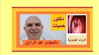 الزوائد القولونية والأورام الحميدة [upl. by Bora]