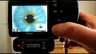 Taking an Iris Image through the LCD Screen  eyePIX Handheld Iridology Camera [upl. by Anival]