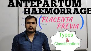 ANTEPARTUM HAEMORRHAGE  PLACENTA PREVIA  APH  PART 1  BY AMAN DAHIYA [upl. by Anatole]