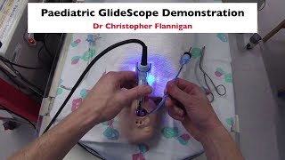 GlideScope Demonstration [upl. by Uokes]