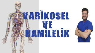 Varikosel Tedavisi Sonrasında Hamilelik İhtimali Nedir [upl. by Fortunna706]