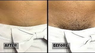 SE RASER LES POILS SANS RASOIR NI CRÈME ÉPILATOIRE EN 5 MINUTES REMOVE UNWANTED HAIR IN 5 MIN [upl. by Idyh]