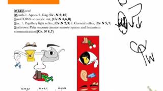 USMLE shortcuts Brainstem death tests2 details [upl. by Ecinej]