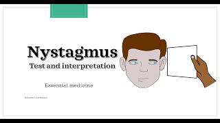 Nystagmus  test and interpretation Essential medicine [upl. by Nylirak596]