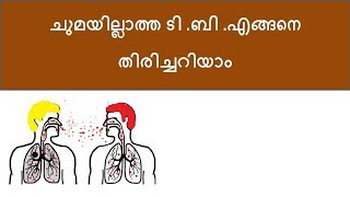 Tuberculous infection Malayalam [upl. by Zielsdorf]