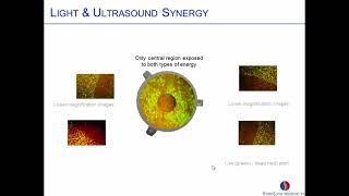 Coincident LightUltrasound Therapy To Treat Bacterial Biofilms [upl. by Scully]