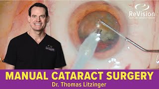 Cataract amp Lens Replacement Surgery at SightTrust Eye Institute [upl. by Lotsyrc333]