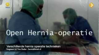 Verschillende hernia operatie technieken [upl. by Cowan]