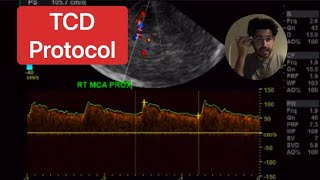 TCD Protocol Transcranial Doppler [upl. by Alius524]