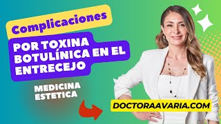 Complicaciones de la Toxina Botulínica en el Entrecejo [upl. by Ynohtnanhoj]