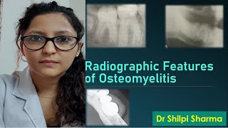 Radiographic Features of Osteomyelitis [upl. by Artenra]