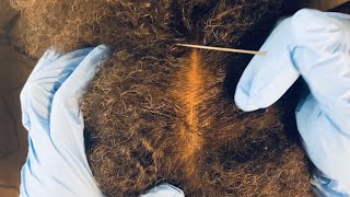 ASMR Aggressive AFRO HAIR Scalp CheckScalp Scratching Using Gloves and Comb No Talking [upl. by Dannon]