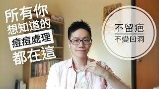 痘痘不留痘疤。全攻略。所有你該知道的都在這了 【Dr Ivan 6】Right Acne Treatment for You 《保養》 [upl. by Favianus296]