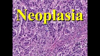 NEOPLASIA ITS DEFINITION TYPES NOMENCLATURE  CHARACTERISTICS AND IDENTIFICATION [upl. by Jakie654]