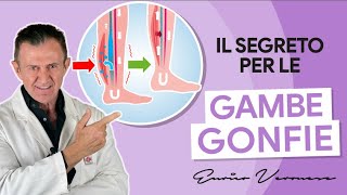 4 Soluzioni Pratiche per la Ritenzione Idrica Gambe e Caviglie [upl. by Merrili601]