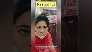 nystagmus seen in a patient I horizontal jerky eye movements l central nystagmus neurology shorts [upl. by Clere758]