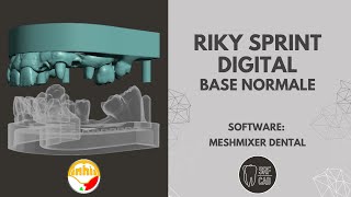 MESHMIXER DENTAL INHIO RIKY SPRINT DIGITAL BASE TUTORIAL INTRAORAL SCAN EXOCAD 3SHAPE [upl. by Geithner]