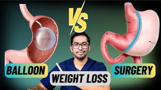 Difference Between Weightloss Balloon amp Weightloss Surgery Explained weightlosstreatment [upl. by Richter]