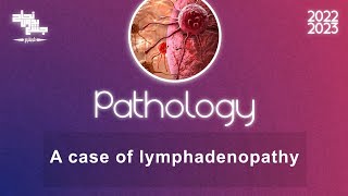 CBL A case of lymphadenopathy Pathology [upl. by Yerfej971]