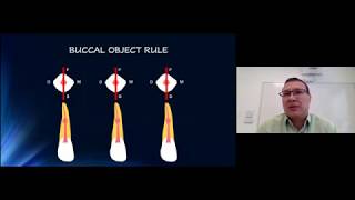 Diagnosis And Management of Dental Resorptive Defects by Dr Aldo Manzur [upl. by Nurav]