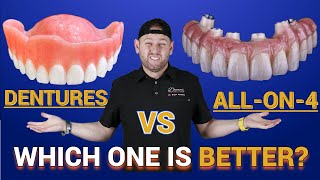 Dentures vs Snap in Dentures vs ALL on 4 ®️ Bridge [upl. by Sitnik773]