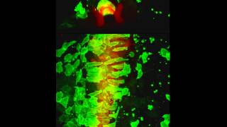 Neural tube construction in zebrafish embryos [upl. by Anawek]