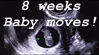 8 weeks ultrasound Baby moves [upl. by Hnaht]