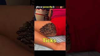 Why do this insect stick 😰 Ticks on human  दुनिया का खतरनाक कीड़ा TICKS🥵 shorts viral [upl. by Aneladgam147]