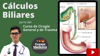 Cálculos Biliares  Curso de Cirugía General y de Trauma [upl. by Nugesulo]