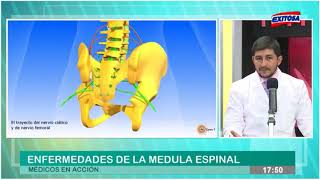 Enfermedades de la médula espinal [upl. by Malia]