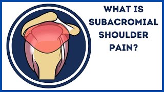 What is subacromial shoulder pain [upl. by Nosae10]