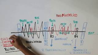 Caracteristicas de los ruidos cardiacos [upl. by Homer]