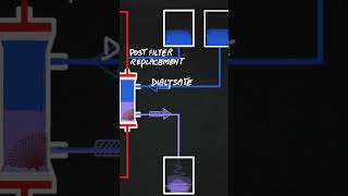 Continuous hemodiafiltration CVVHDF [upl. by Melan]