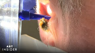 Water Device Painlessly Removes Earwax  Art Insider [upl. by Leopoldine]