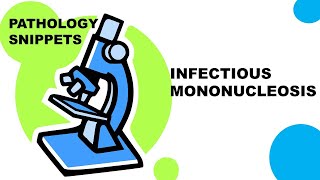 INFECTIOUS MONONUCLEOSIS [upl. by Sayles]