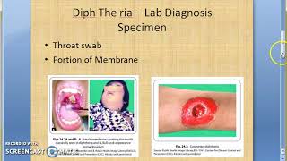 Microbiology 213 b Diptheria Lab Diagnosis [upl. by Atinot539]