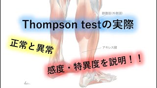 Thompson testはアキレス腱断裂を疑ったら必ずすべき！ [upl. by Darreg]