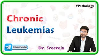 17 Chronic Leukemias  CML and CLL  USMLE Step 1 Pathology [upl. by Martella]