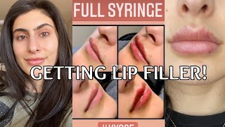 I GOT LIP FILLER Before After and Healing Process Restylane Kysse Lip Filler [upl. by Kariotta]