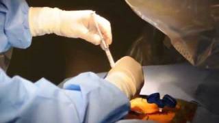 Vertebroplasty Live Procedure Hussien ElMaghraby [upl. by Devehcoy287]