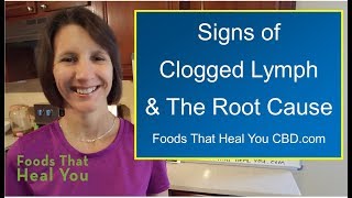 The Root Cause of Clogged Lymphatic System [upl. by Jestude315]