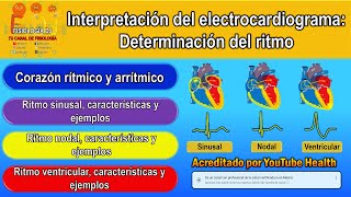 Electrocardiograma interpretación  Electrocardiograma  Determinación del ritmo  Ejemplos [upl. by Riplex]