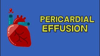 PERICARDIAL EFFUSION [upl. by Idissac]