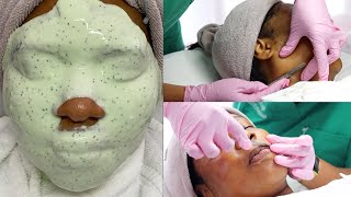 Watch  Full Dermaplaning Facial Treatment [upl. by Draneb]