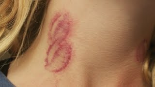 how to make a fake hickey with water bottle tutorial [upl. by Tychonn]