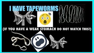 ROPE WORM OR TAPE WORM [upl. by Rainwater526]