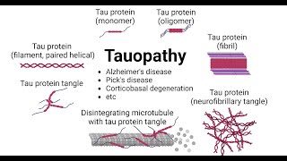 Microglial activation and tau transmission aggravated by Galectin3 in tauopathy [upl. by Gnuj]