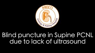 Blind puncture in Supine PCNL due to lack of Ultrasound [upl. by Hgielar]