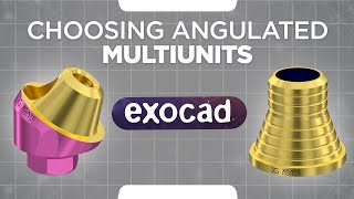 Exocad tutorial  Choosing angulated multi units  How to work with ExoCad library [upl. by Leissam]